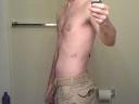 paintball_bruise1.jpg