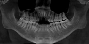 Xray1 2014-05-07