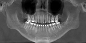 Xray1 2015-10-07