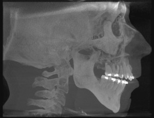 Xray2 2015-10-07