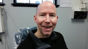 I think my surgeon implanted dimples during the surgery.